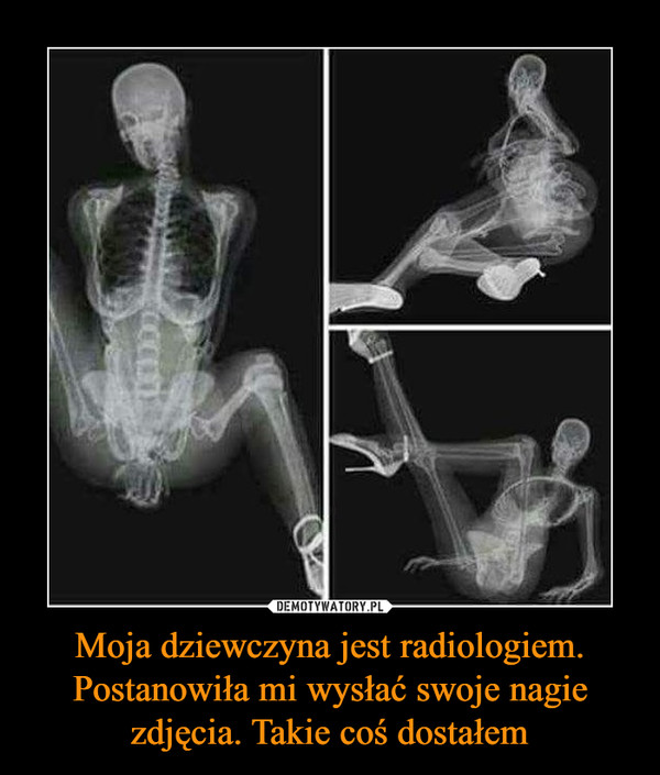 Moja dziewczyna jest radiologiem. Postanowiła mi wysłać swoje nagie zdjęcia. Takie coś dostałem
