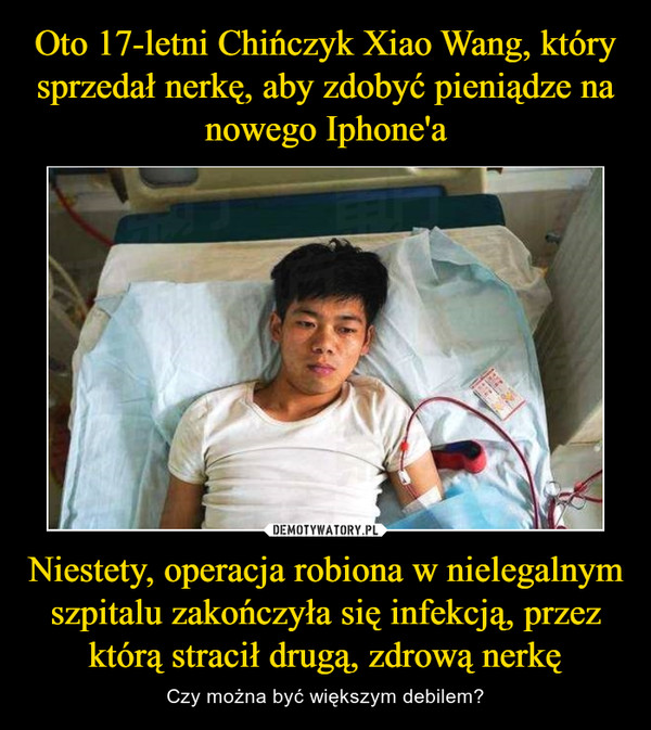 Oto 17-letni Chińczyk Xiao Wang, który sprzedał nerkę, aby zdobyć pieniądze na nowego Iphone'a Niestety, operacja robiona w nielegalnym szpitalu zakończyła się infekcją, przez którą stracił drugą, zdrową nerkę
