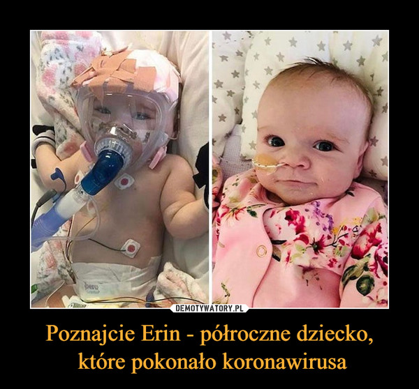 Poznajcie Erin - półroczne dziecko, które pokonało koronawirusa –  