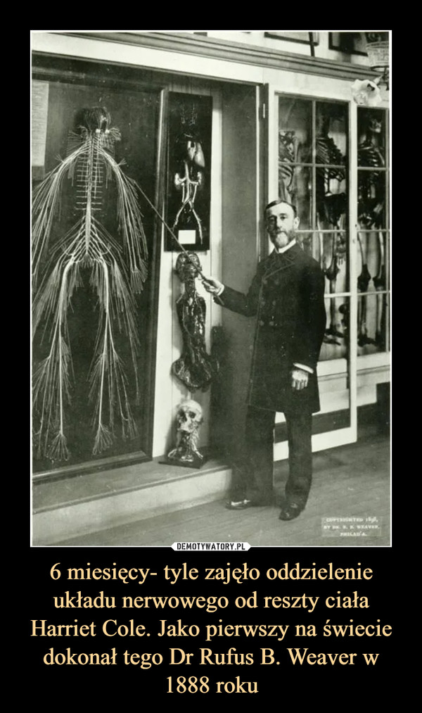 6 miesięcy- tyle zajęło oddzielenie układu nerwowego od reszty ciała Harriet Cole. Jako pierwszy na świecie dokonał tego Dr Rufus B. Weaver w 1888 roku –  