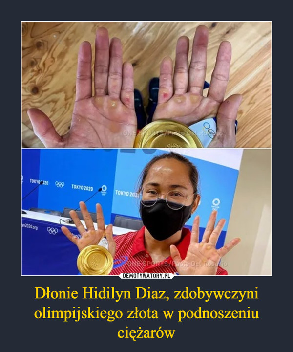 Dłonie Hidilyn Diaz, zdobywczyni olimpijskiego złota w podnoszeniu ciężarów –  