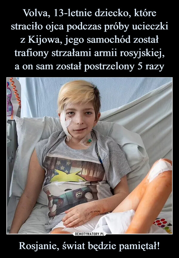 Volva, 13-letnie dziecko, które straciło ojca podczas próby ucieczki z Kijowa, jego samochód został trafiony strzałami armii rosyjskiej,
a on sam został postrzelony 5 razy Rosjanie, świat będzie pamiętał!
