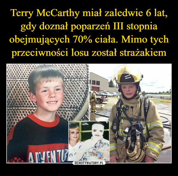 Terry McCarthy miał zaledwie 6 lat, gdy doznał poparzeń III stopnia obejmujących 70% ciała. Mimo tych przeciwności losu został strażakiem