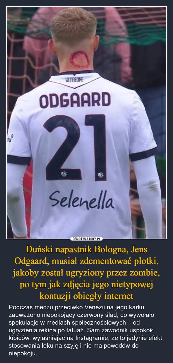 Duński napastnik Bologna, Jens Odgaard, musiał zdementować plotki, jakoby został ugryziony przez zombie, po tym jak zdjęcia jego nietypowej kontuzji obiegły internet – Podczas meczu przeciwko Venezii na jego karku zauważono niepokojący czerwony ślad, co wywołało spekulacje w mediach społecznościowych – od ugryzienia rekina po tatuaż. Sam zawodnik uspokoił kibiców, wyjaśniając na Instagramie, że to jedynie efekt stosowania leku na szyję i nie ma powodów do niepokoju. HEAREONEODGAARD21Selenella
